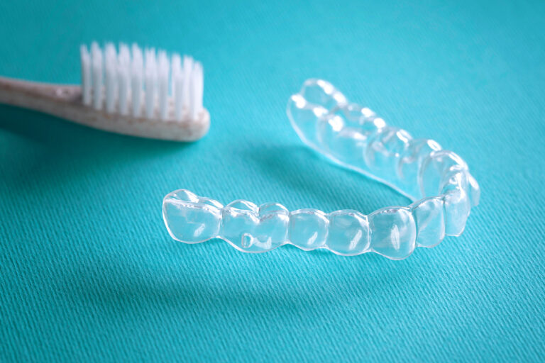 zahnarzt-marienkirche-ochtrup-leistungen-knirscherschiene-leistungen-ueberblick