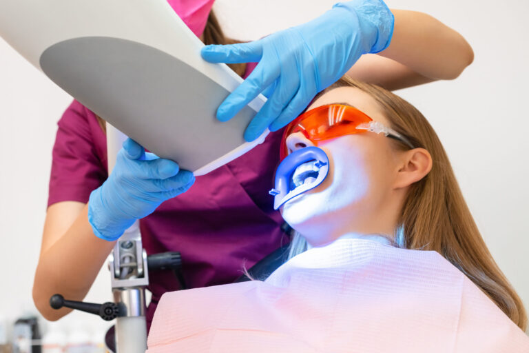 zahnärztin_pieper_ochtrup_blogbeitrag_bleaching_ochtrup